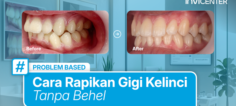 Gigi Kelinci Bisa Hilang Tanpa Behel? Ini Jawabannya!