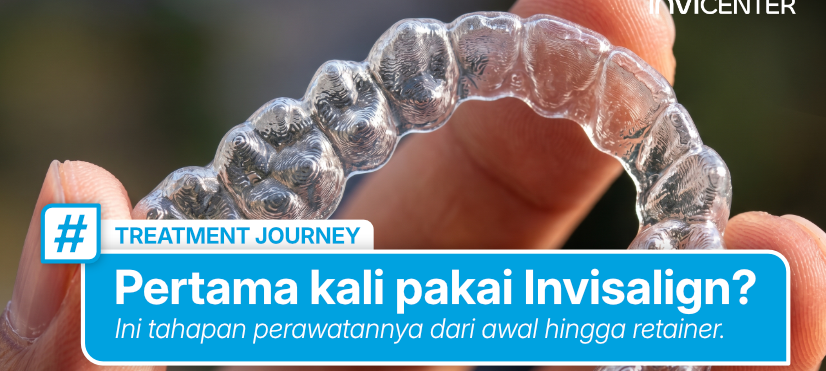 Pertama Kali Pakai Invisalign? Ini Tahapan Perawatannya dari Awal hingga Retainer