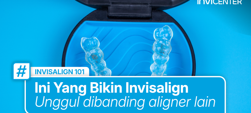 Aligner Gigi Itu Sama? Ini yang Perlu Kamu Tahu Sebelum Memilih Invisalign