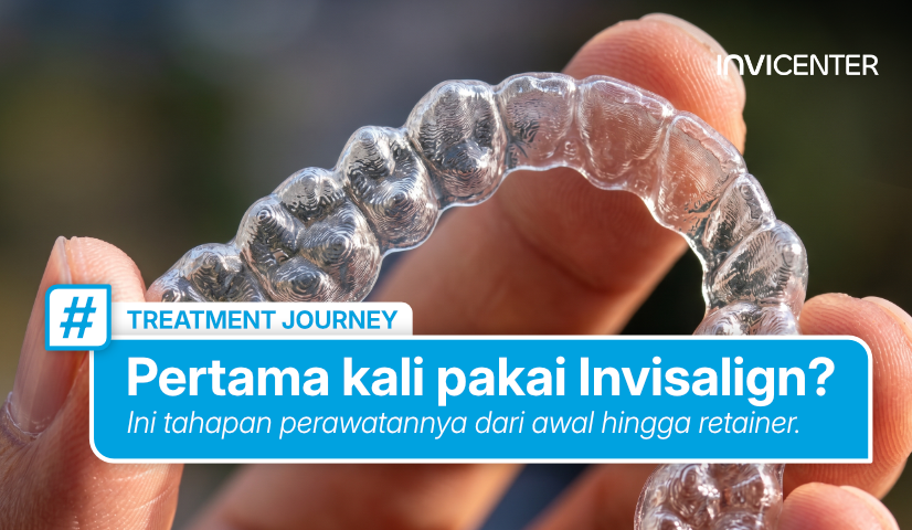 Pertama Kali Pakai Invisalign? Ini Tahapan Perawatannya dari Awal hingga Retainer
