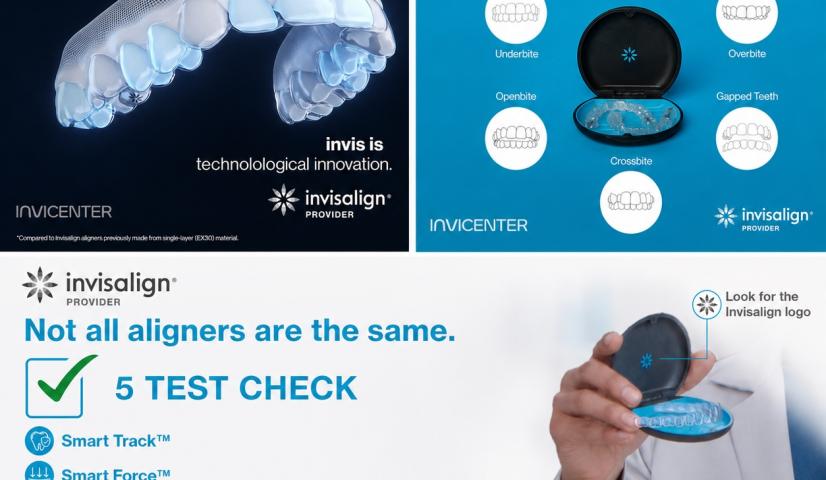 Harga Invisalign di Jakarta: Apa yang Sebenarnya Anda Bayar?